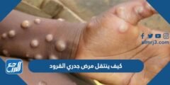 كيف ينتقل مرض جدري القرود 2025 3 كيف ينتقل مرض جدري القرود