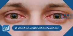 سبب العيون الحمراء التي تظهر في صور الأشخاص هو 2025 2 سبب العيون الحمراء التي تظهر في صور الأشخاص هو
