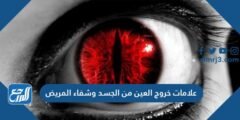 علامات خروج العين من الجسد وشفاء المريض