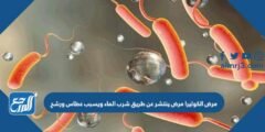 مرض الكوليرا مرض ينتشر عن طريق شرب الماء ويسبب عطاس ورشح 2025 2 مرض الكوليرا مرض ينتشر عن طريق شرب الماء ويسبب عطاس ورشح