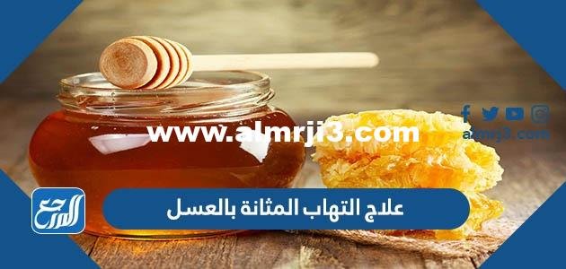 علاج التهاب المثانة بالعسل - 2025 1 علاج التهاب المثانة بالعسل - موقع المرجع