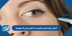 أفضل عيادة حقن الفيلر تحت العين في السعودية عن تجربة