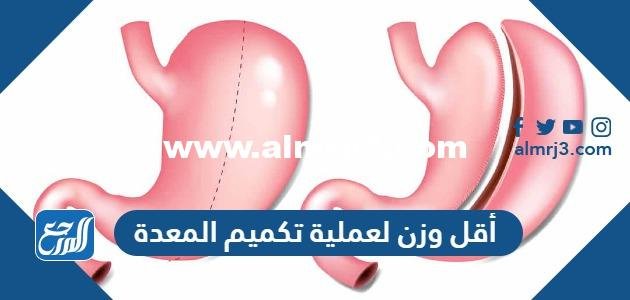 كم أقل وزن لعملية تكميم المعدة من تجاربكم 2025 2 كم أقل وزن لعملية تكميم المعدة من تجاربكم