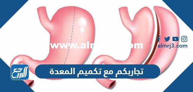 تجاربكم مع تكميم المعدة بالتفصيل 2025 2 تجاربكم مع تكميم المعدة بالتفصيل