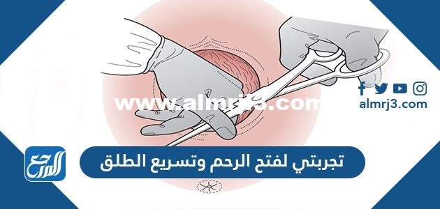 تجربتي لفتح الرحم وتسريع الطلق 2025 1 تجربتي لفتح الرحم وتسريع الطلق