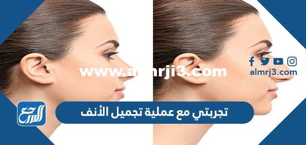 تجربتي مع عملية تجميل الأنف 2025 1 تجربتي مع عملية تجميل الأنف