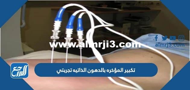 تكبير المؤخره بالدهون الذاتيه تجربتي - 2025 2 تكبير المؤخره بالدهون الذاتيه تجربتي - موقع المرجع