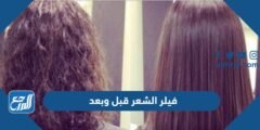 فيلر الشعر قبل وبعد - 2025 3 فيلر الشعر قبل وبعد - موقع المرجع