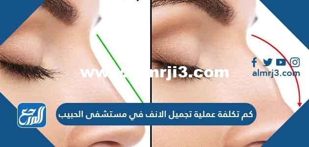 كم تكلفة عملية تجميل الانف في مستشفى الحبيب