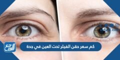 كم سعر حقن الفيلر تحت العين في جدة 2025 3 كم سعر حقن الفيلر تحت العين في جدة