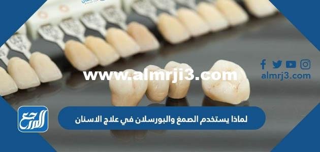 لماذا يستخدم الصمغ والبورسلان في علاج الاسنان 2025 3 لماذا يستخدم الصمغ والبورسلان في علاج الاسنان