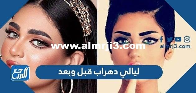 ليالي دهراب قبل وبعد - محتوي حصري 2025 2 ليالي دهراب قبل وبعد - موقع المرجع