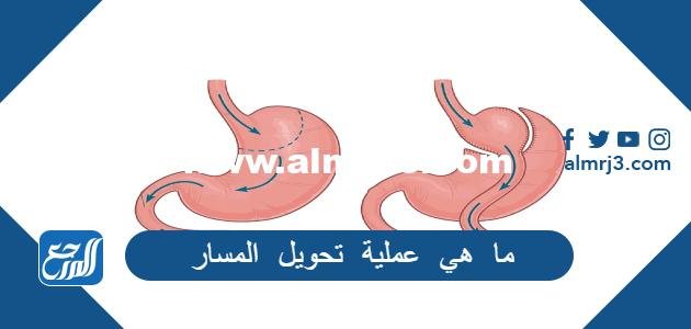 ما هي عملية تحويل المسار 2025 3 ما هي عملية تحويل المسار