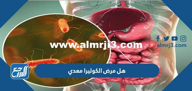 هل مرض الكوليرا معدي - موقع المرجع