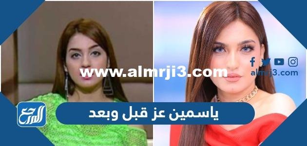 ياسمين عز قبل وبعد - موقع المرجع